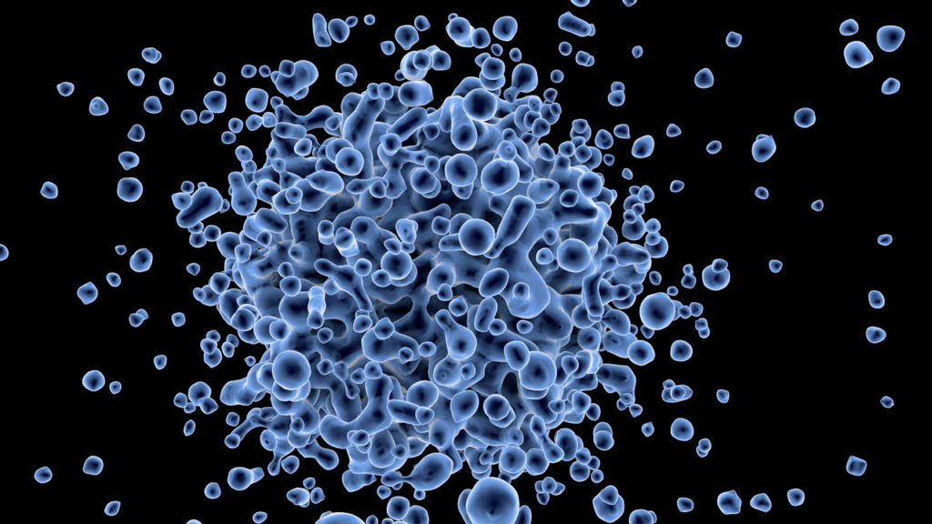Tumor de Pâncreas